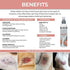 Veterinary Formula Clinical Care Hot Spot & Itch Relief Medicated Spray 8 oz